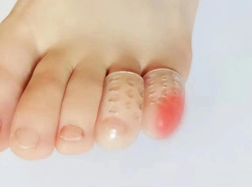 FitVille Anti - Friction Toe Cover (30 Pack) - 1